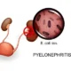 previous thumbnail